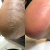 Nails of the day - Podology+ KERATOLITIC - Bőrpuhító spray 100 ml